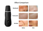 Ultrasonic Rechargeable Face Skin Scrubber Facial Cleaner - blitz-styles